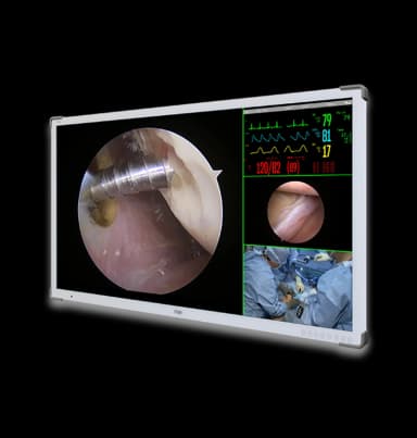 Медичний дисплей FSN FM-A5504DS-DG